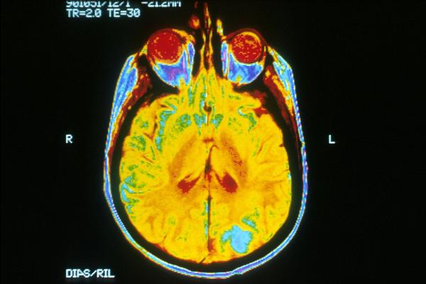 1620px Brain MRI